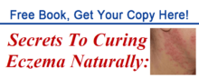 Curing-Eczema-book